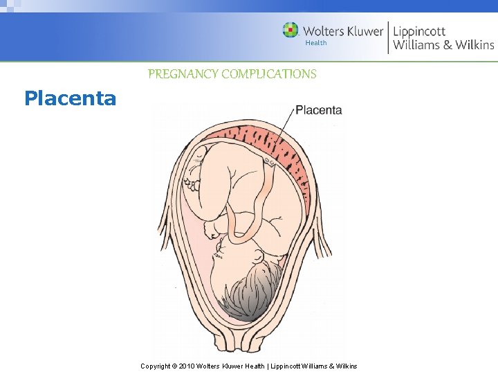 PREGNANCY COMPLICATIONS Placenta Copyright © 2010 Wolters Kluwer Health | Lippincott Williams & Wilkins