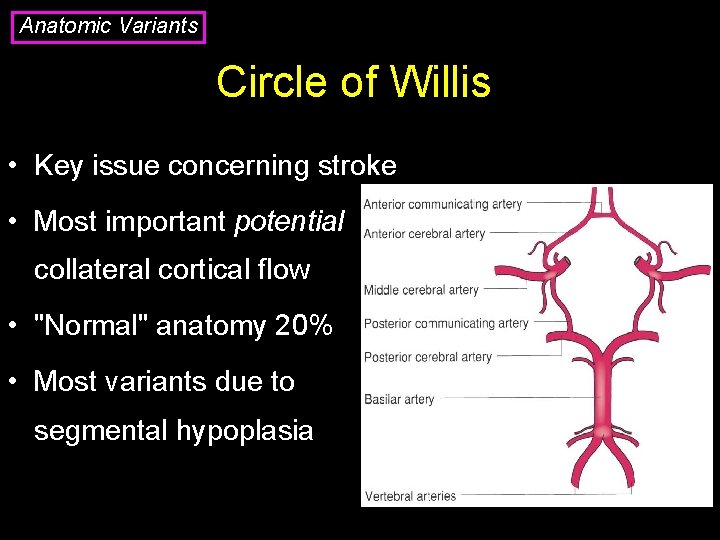 Anatomic Variants Circle of Willis • Key issue concerning stroke • Most important potential