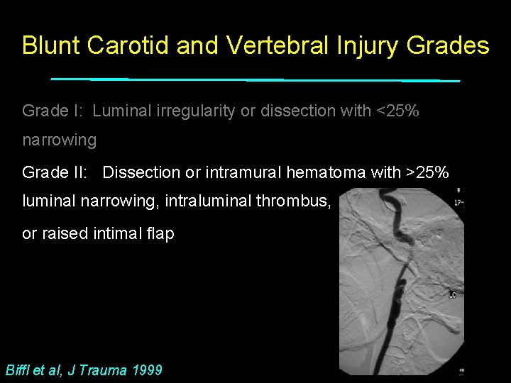 Blunt Carotid and Vertebral Injury Grades Grade I: Luminal irregularity or dissection with <25%