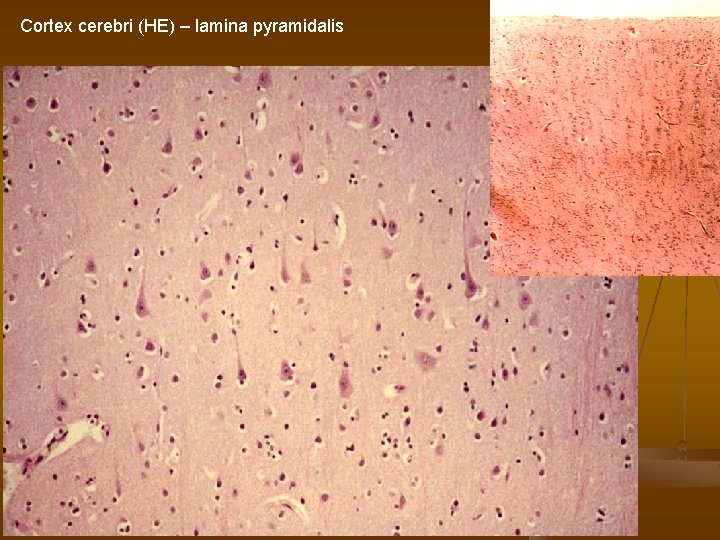 Cortex cerebri (HE) – lamina pyramidalis 