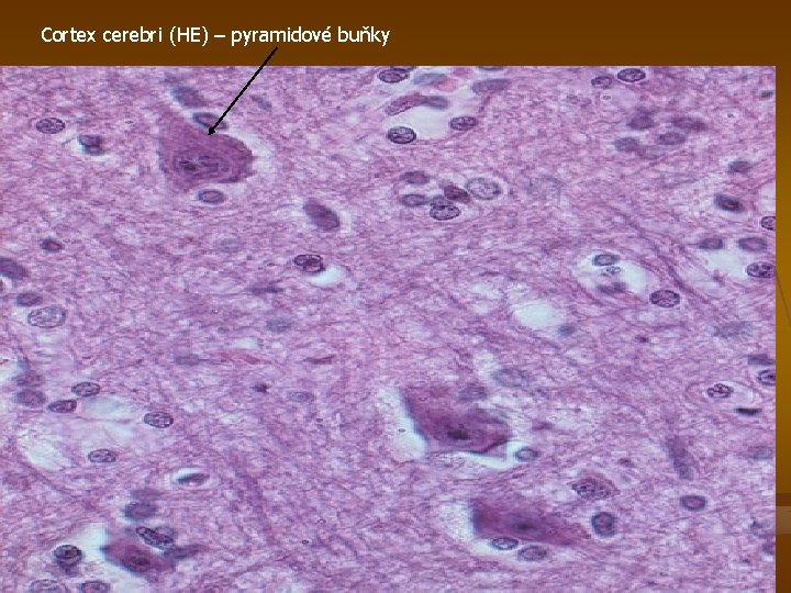 Cortex cerebri (HE) – pyramidové buňky 