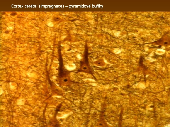 Cortex cerebri (impregnace) – pyramidové buňky 