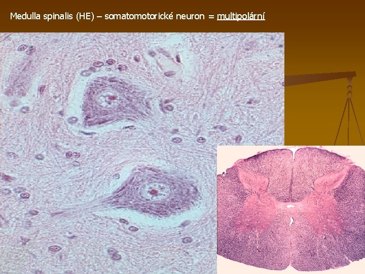 Medulla spinalis (HE) – somatomotorické neuron = multipolární 