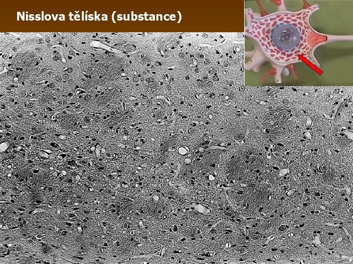 Nisslova tělíska (substance) 