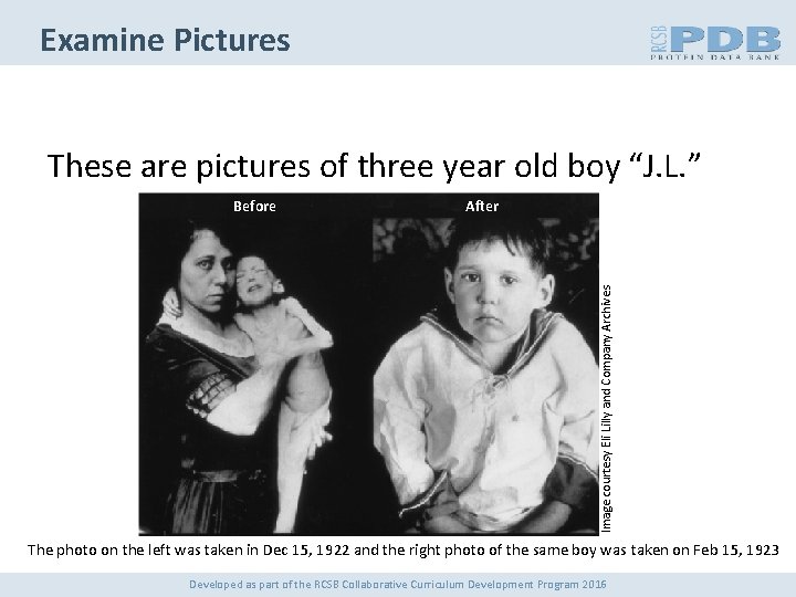 Examine Pictures These are pictures of three year old boy “J. L. ” After