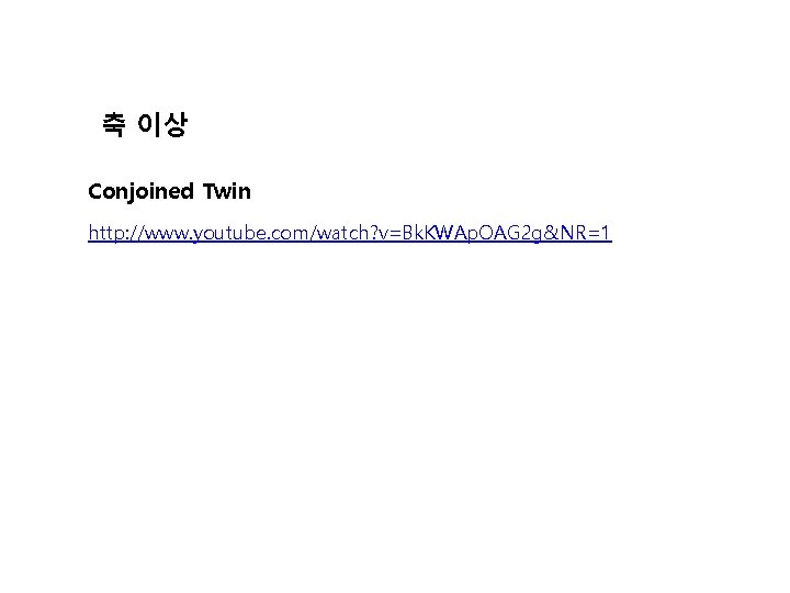 축 이상 Conjoined Twin http: //www. youtube. com/watch? v=Bk. KWAp. OAG 2 g&NR=1 