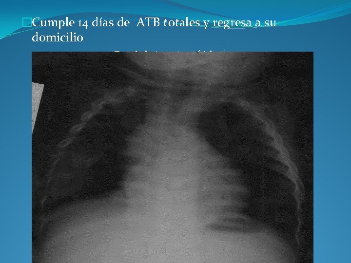 �Cumple 14 días de ATB totales y regresa a su domicilio Rx del 6/10/08