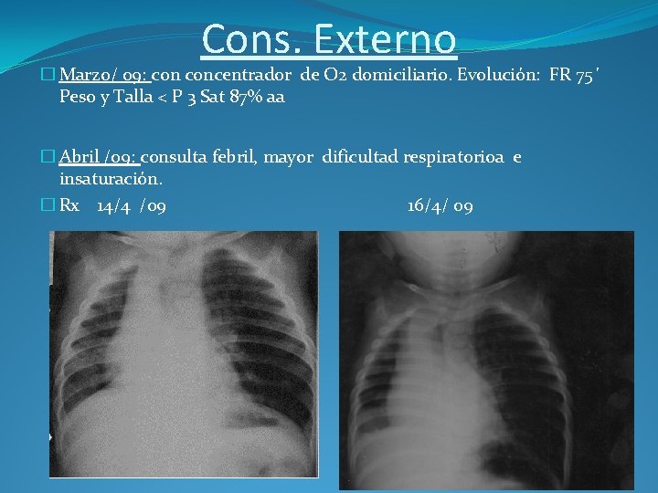 Cons. Externo � Marzo/ 09: concentrador de O 2 domiciliario. Evolución: FR 75´ Peso