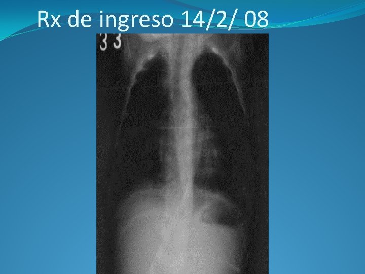 Rx de ingreso 14/2/ 08 