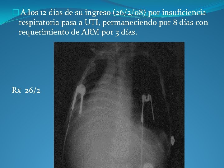 � A los 12 días de su ingreso (26/2/08) por insuficiencia respiratoria pasa a