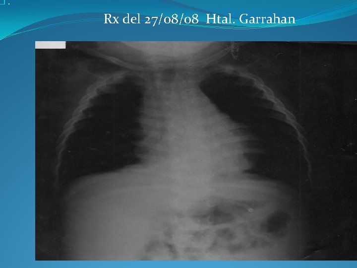 �. Rx del 27/08/08 Htal. Garrahan 