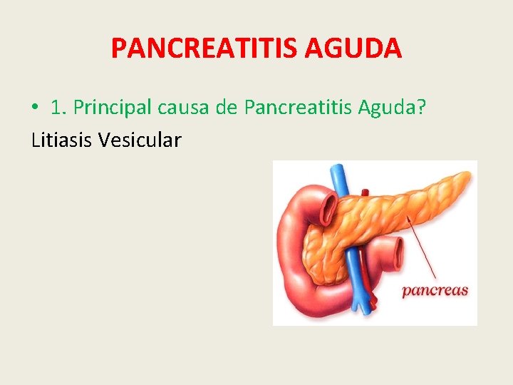 PANCREATITIS AGUDA • 1. Principal causa de Pancreatitis Aguda? Litiasis Vesicular 