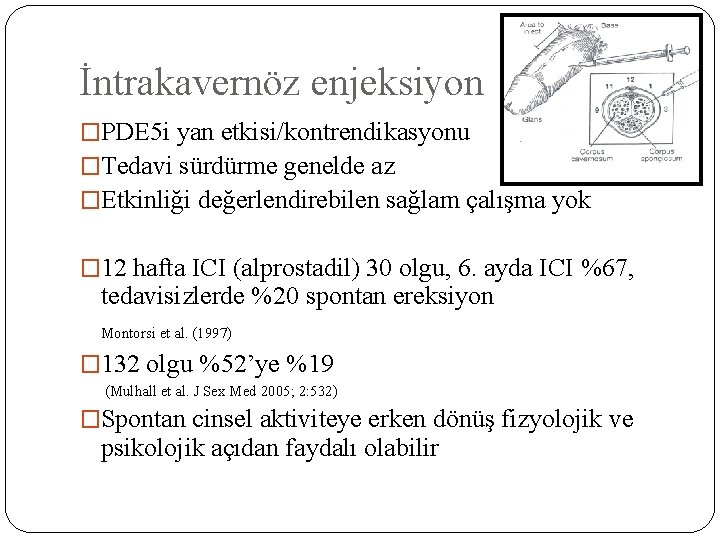 İntrakavernöz enjeksiyon �PDE 5 i yan etkisi/kontrendikasyonu �Tedavi sürdürme genelde az �Etkinliği değerlendirebilen sağlam