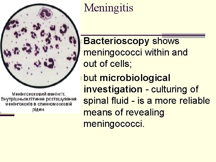 Meningitis n Bacterioscopy shows meningococci within and out of cells; n but microbiological investigation