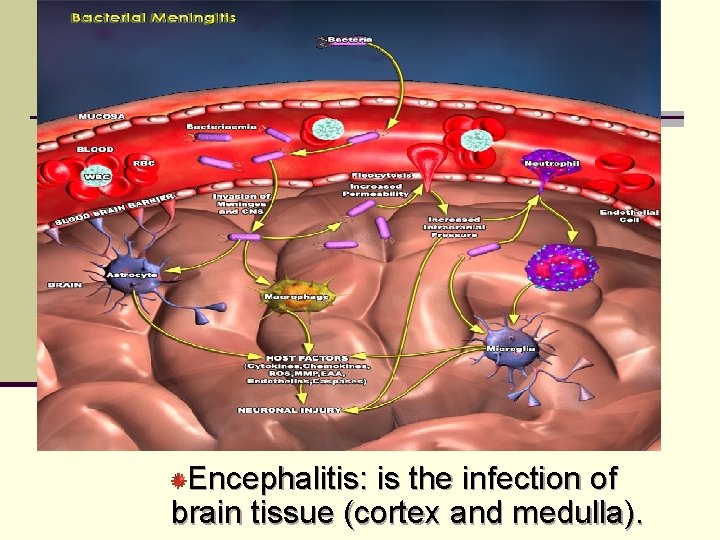 Encephalitis: is the infection of brain tissue (cortex and medulla). 