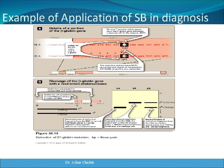 Example of Application of SB in diagnosis of mutation in globin gene Dr. Azhar