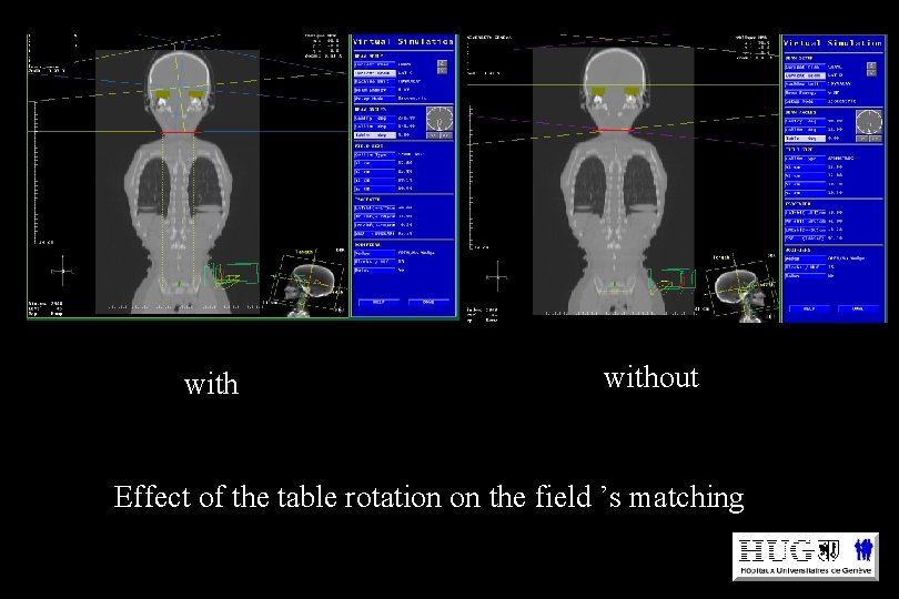 without Effect of the table rotation on the field ’s matching 