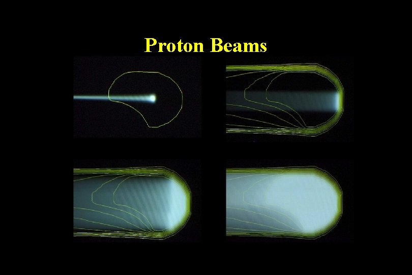 Proton Beams Proton Beams