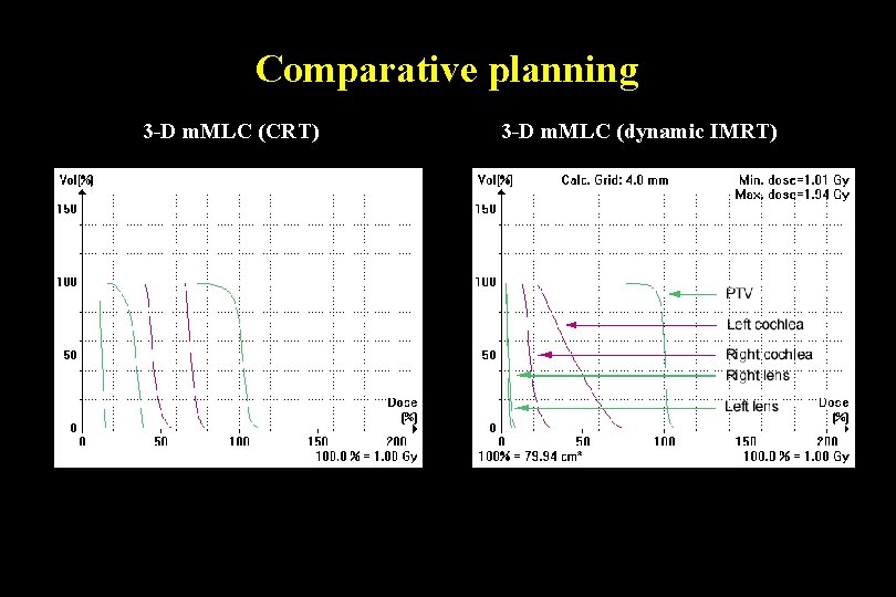 Comparative planning 3 -D m. MLC (CRT) 3 -D m. MLC (dynamic IMRT) 