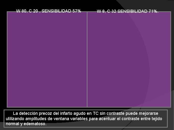 W 80, C 20 , SENSIBILIDAD 57% W 8, C 32 SENSIBILIDAD 71%. La