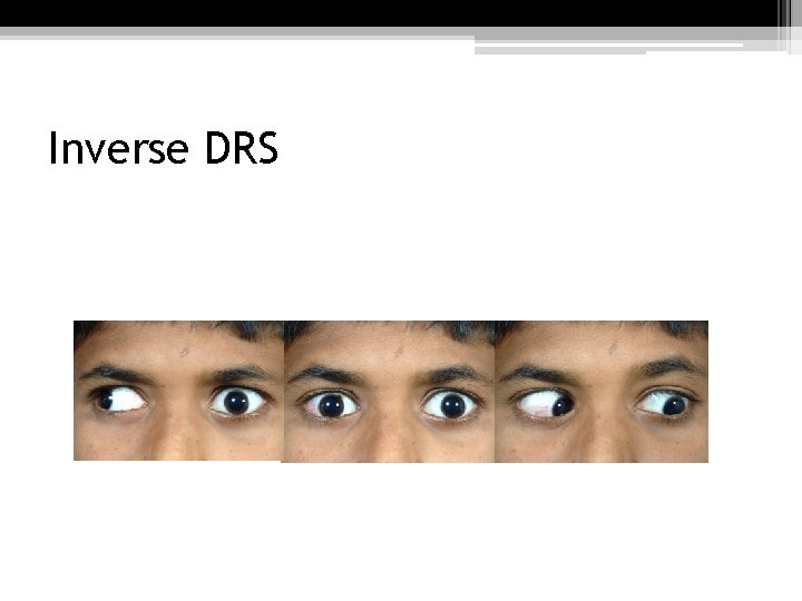 Inverse DRS 