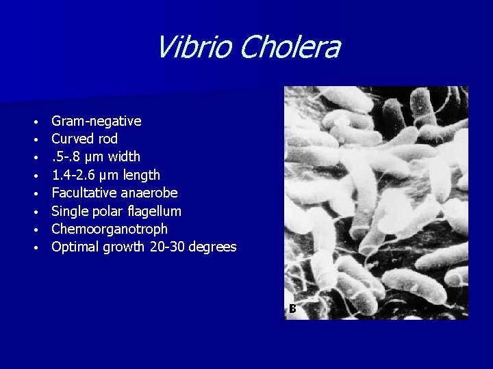 Vibrio Cholera • • Gram-negative Curved rod. 5 -. 8 μm width 1. 4