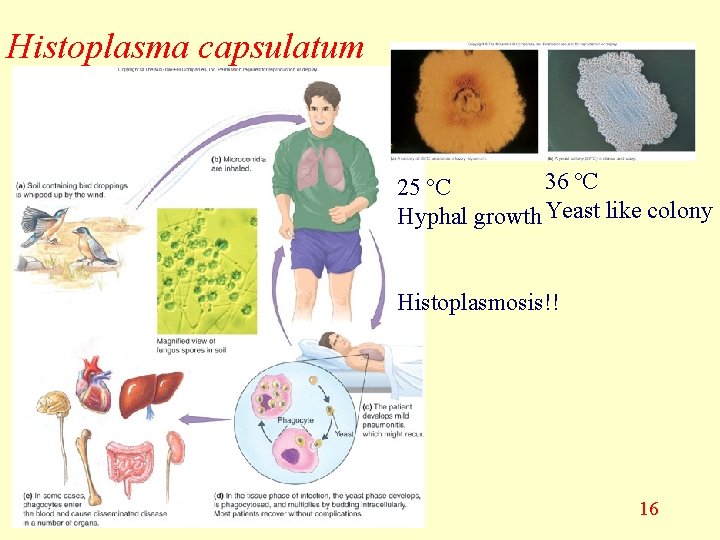 Histoplasma capsulatum 36 ºC 25 ºC Hyphal growth Yeast like colony Histoplasmosis!! 16 