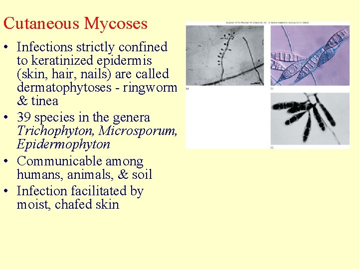 Cutaneous Mycoses • Infections strictly confined to keratinized epidermis (skin, hair, nails) are called