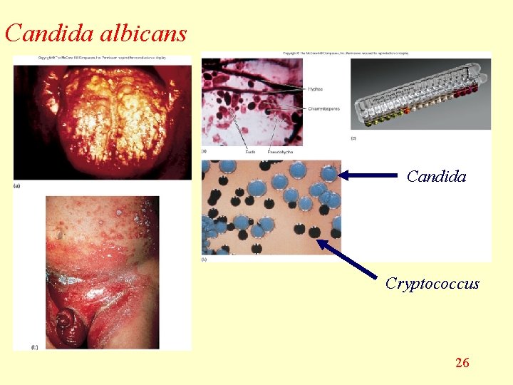 Candida albicans Candida Cryptococcus 26 