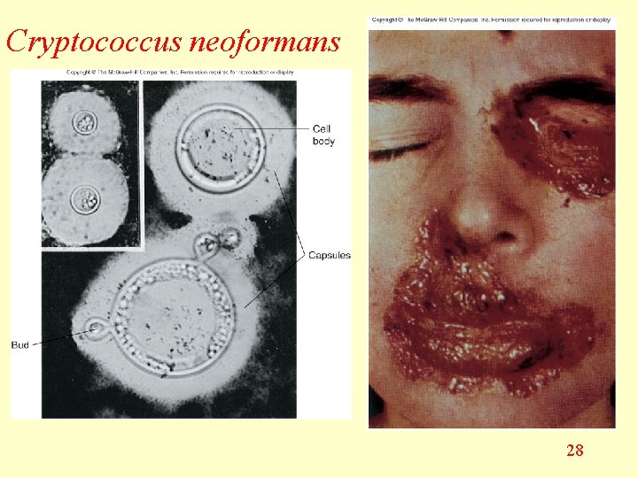 Cryptococcus neoformans 28 