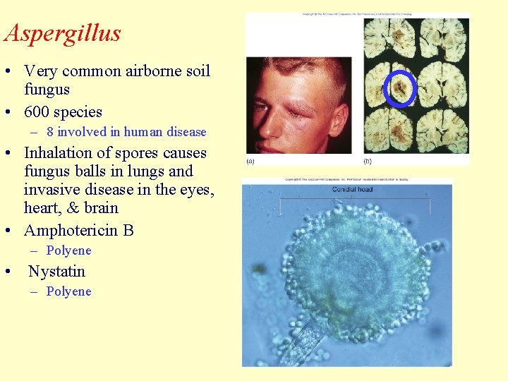 Aspergillus • Very common airborne soil fungus • 600 species – 8 involved in