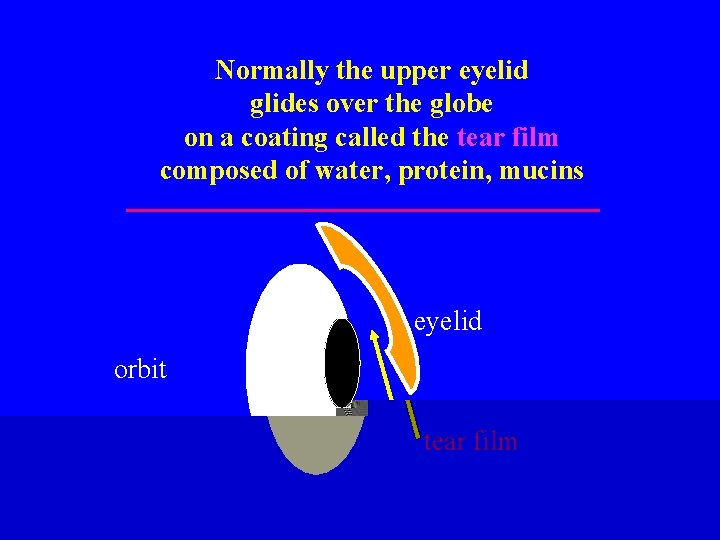 Normally the upper eyelid glides over the globe on a coating called the tear