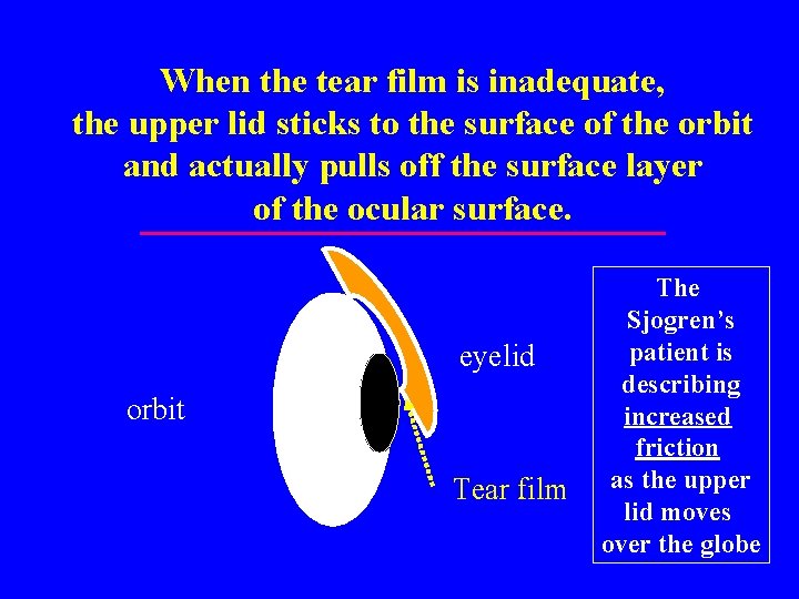 When the tear film is inadequate, the upper lid sticks to the surface of