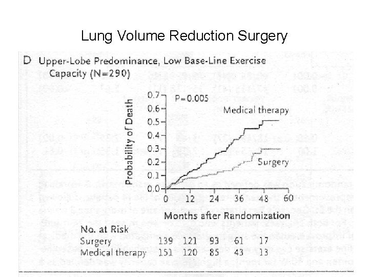 Lung Volume Reduction Surgery 