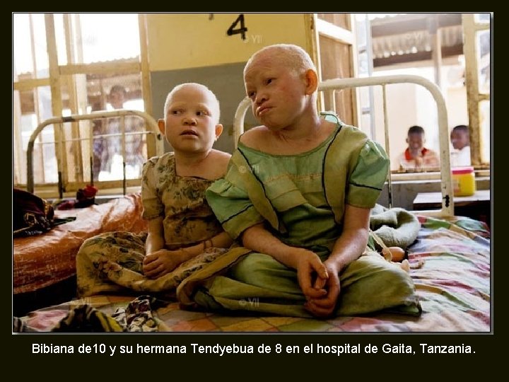 Bibiana de 10 y su hermana Tendyebua de 8 en el hospital de Gaita,