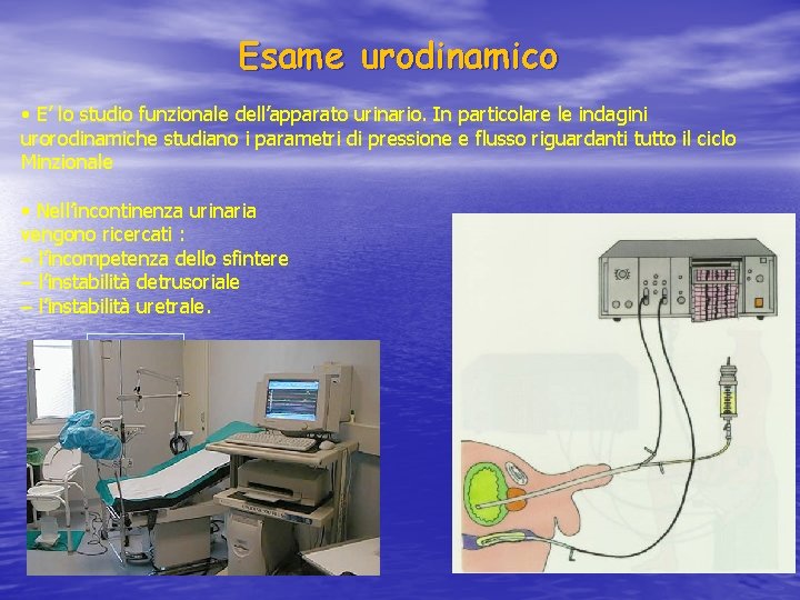 Esame urodinamico • E’ lo studio funzionale dell’apparato urinario. In particolare le indagini urorodinamiche