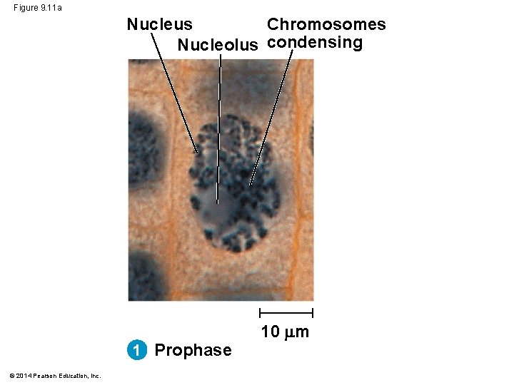 Figure 9. 11 a Chromosomes Nucleus Nucleolus condensing 1 Prophase © 2014 Pearson Education,