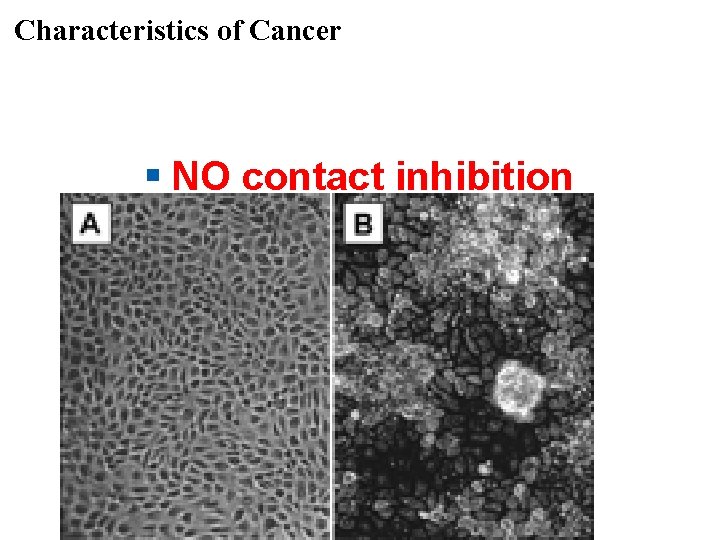 Characteristics of Cancer § NO contact inhibition 