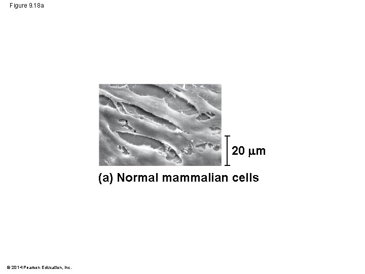 Figure 9. 18 a 20 m (a) Normal mammalian cells © 2014 Pearson Education,