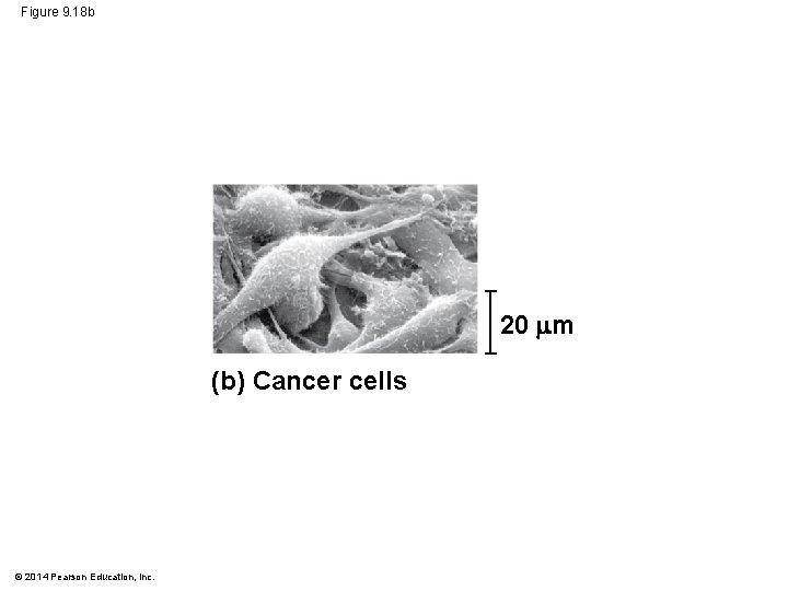 Figure 9. 18 b 20 m (b) Cancer cells © 2014 Pearson Education, Inc. Figure 9. 18 b 20 m (b) Cancer cells © 2014 Pearson Education, Inc.