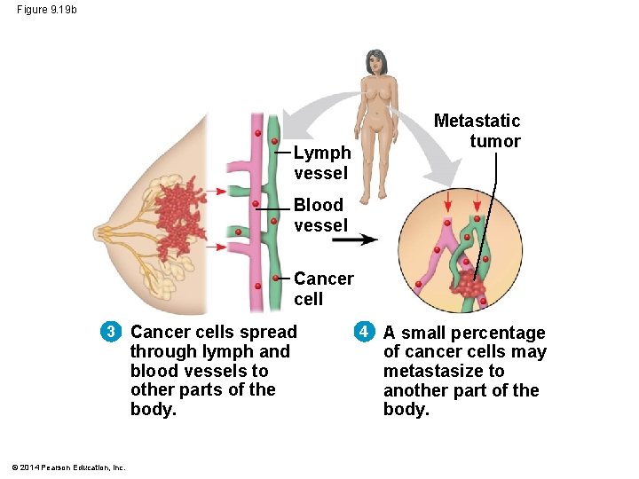 Figure 9. 19 b Lymph vessel Metastatic tumor Blood vessel Cancer cell 3 Cancer