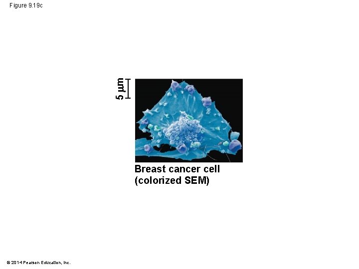 5 m Figure 9. 19 c Breast cancer cell (colorized SEM) © 2014 Pearson 5 m Figure 9. 19 c Breast cancer cell (colorized SEM) © 2014 Pearson