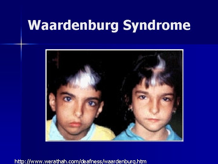 Waardenburg Syndrome http: //www. werathah. com/deafness/waardenburg. htm 
