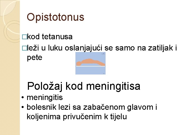 Opistotonus �kod tetanusa �leži u luku oslanjajući se samo na zatiljak i pete Položaj