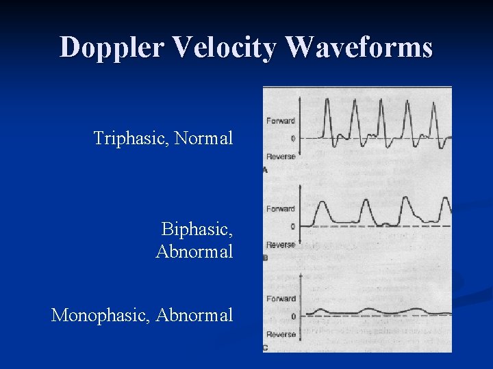 Doppler Velocity Waveforms Triphasic, Normal Biphasic, Abnormal Monophasic, Abnormal 