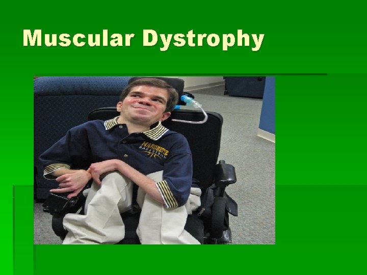 Muscular Dystrophy 