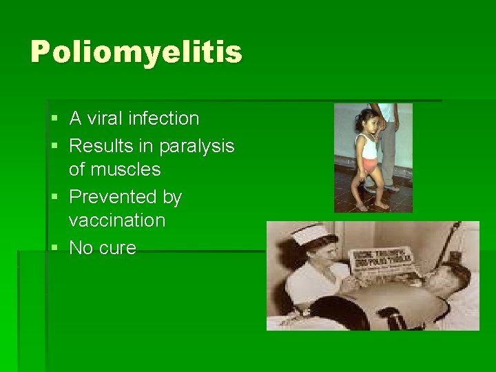 Poliomyelitis § A viral infection § Results in paralysis of muscles § Prevented by
