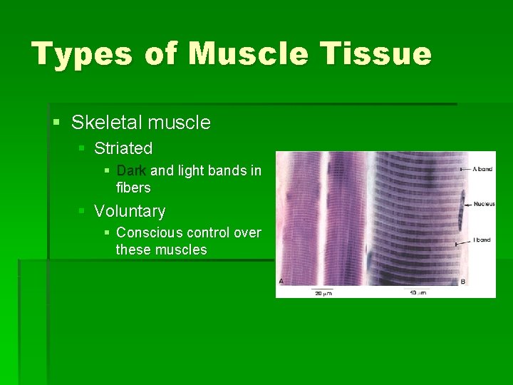 Types of Muscle Tissue § Skeletal muscle § Striated § Dark and light bands