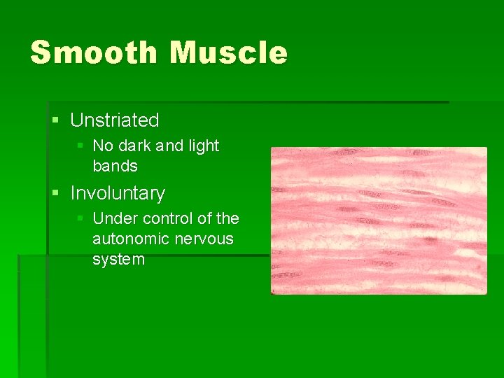 Smooth Muscle § Unstriated § No dark and light bands § Involuntary § Under