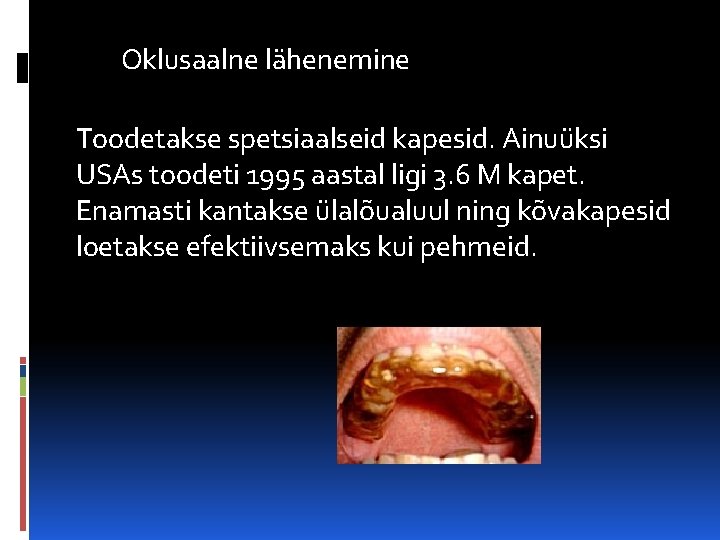  Oklusaalne lähenemine Toodetakse spetsiaalseid kapesid. Ainuüksi USAs toodeti 1995 aastal ligi 3. 6